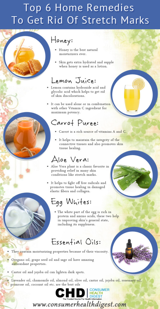 Once and for All Home Remedies To Get Rid Of Stretch Marks An