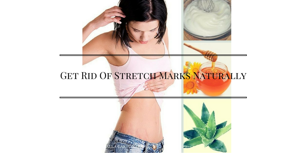 Get Rid Of Stretch Marks Naturally