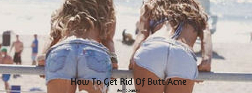 How To Get Rid Of Butt Acne