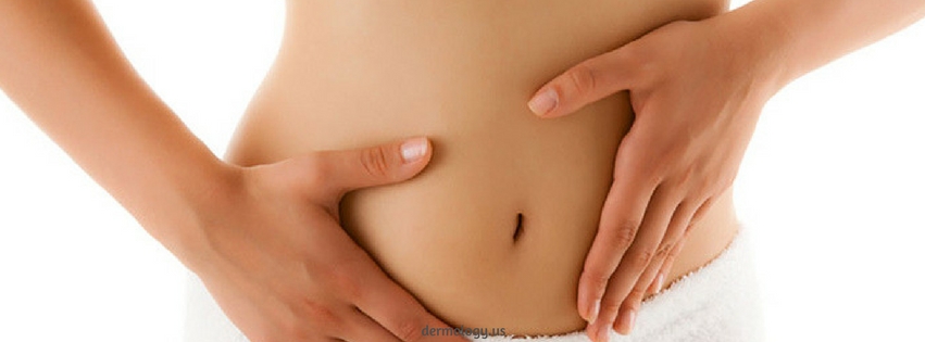 Home Remedies To Remove Stretch Marks