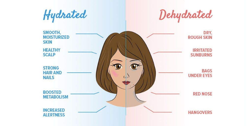 Dehydrated Vs Hydrated For Skin