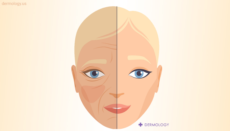 Aging Skin